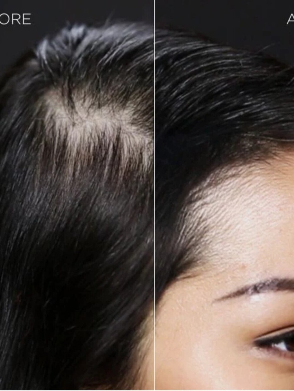 Toppik hair fiber (Dark Brown) - Picture 5 of 6